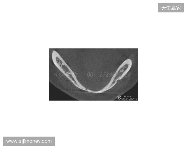 韦林顿确诊上唇部贯通伤;11、21牙半脱位;上颌前牙区牙槽骨骨折 韦林顿确诊上唇部贯通伤;11、21牙半脱位;上颌前牙区牙槽骨骨折